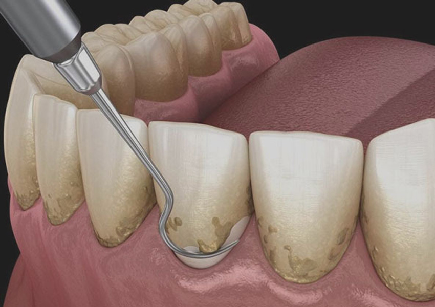 Periodontoloji